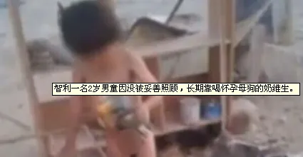 智利2岁男童长期喝母狗奶维生 身上感染皮肤病及大量虱子 | 宠物新闻资讯