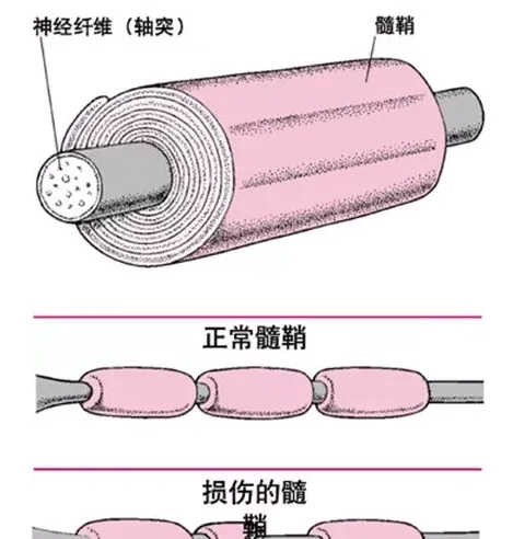 狗狗是如何感染犬瘟的，犬瘟晚期能注射单抗治疗吗? | 宠物狗病虫害防治