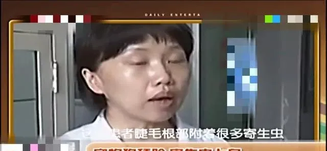 狗狗爱舔女主人脸，医生一句话让人后背发凉！ | 宠物新闻资讯