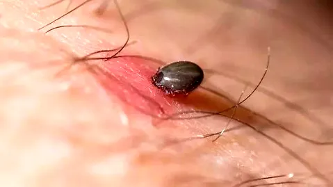 狗狗身上有蜱虫怎么办？教你一个快速有效的办法 | 宠物狗病虫害防治