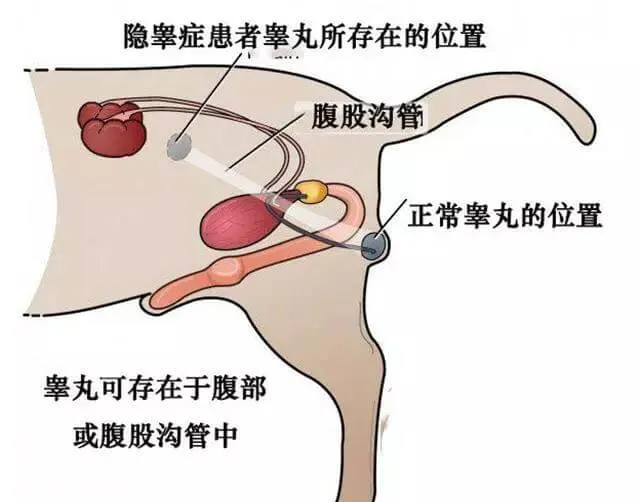 狗狗只有一颗蛋蛋？或是隐睾症！不找回迷途睾丸，或导致恶性肿瘤 | 宠物狗病虫害防治