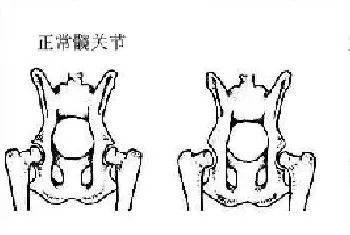 狗狗脚不敢着地|瘸了,可能包括哪些原因?