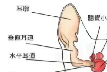 别再用棉签给宠物掏耳朵